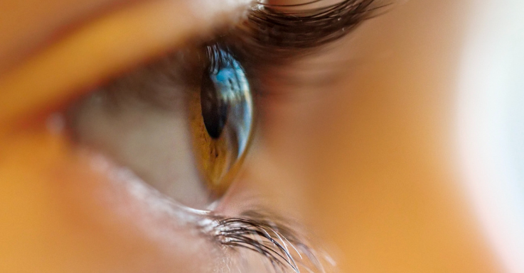 Ein:e Optiker:in kann überprüfen, wie die Kontaklinse auf dem Auge sitzt.
